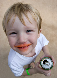 boy with seemingly disproprortionate features